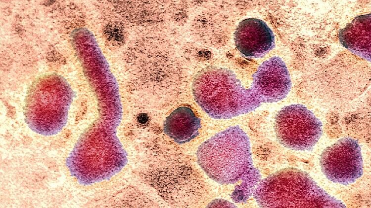 Scientists Find Bird Flu Mutation Could Spread More Easily to Humans 🦠 Single H5N1 mutation enables easier human infection: study