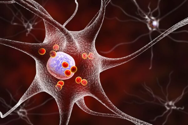 Chinese Researchers Discover New Hope for Treating Parkinson’s Disease Chinese researchers find new target to treat Parkinson's disease