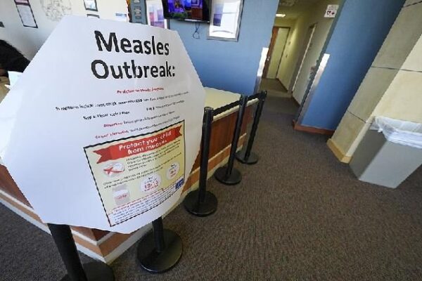 Measles Outbreak Hits Texas: What You Need to Know U.S. sees surge in measles cases, Texas hit hardest