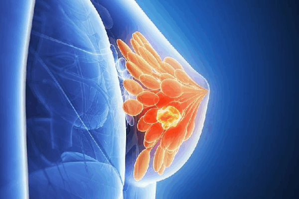 Researchers uncover cancer dormancy, hint at new treatments