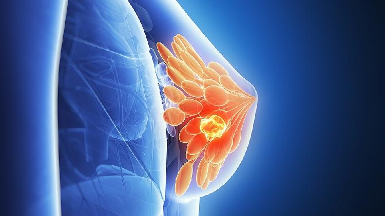 Researchers uncover cancer dormancy, hint at new treatments