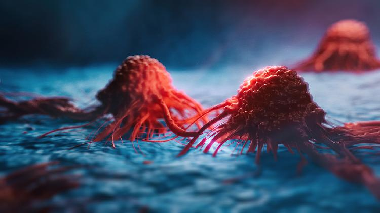Study reveals how tumors hijack key nutrient to evade immune attack