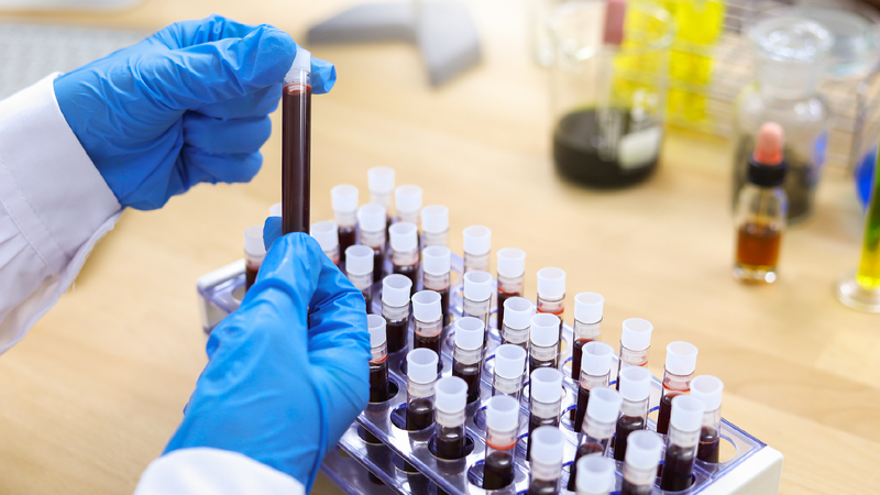 The_latest_in_hemophilia_treatment_New_techniques_new_research - My Global News: Young Voices The latest in hemophilia treatment: New techniques, new research