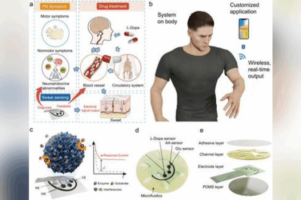 New Wearable Patch Helps Spot Parkinson’s Disease Early! 🧪 Chinese scientists make wearable pad for Parkinson's disease warning