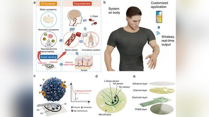 Chinese scientists make wearable pad for Parkinson's disease warning