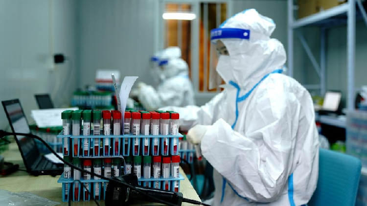 Politics won't give us facts of coronavirus origins