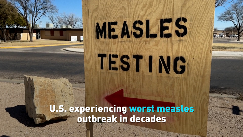Measles Makes a Comeback in the U.S.: What You Need to Know U.S. experiencing worst measles outbreak in decades video poster